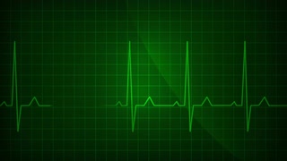 ekg-ecg-monitor-electrocardiogram-display-looping_ed1qtpjoe__S0000